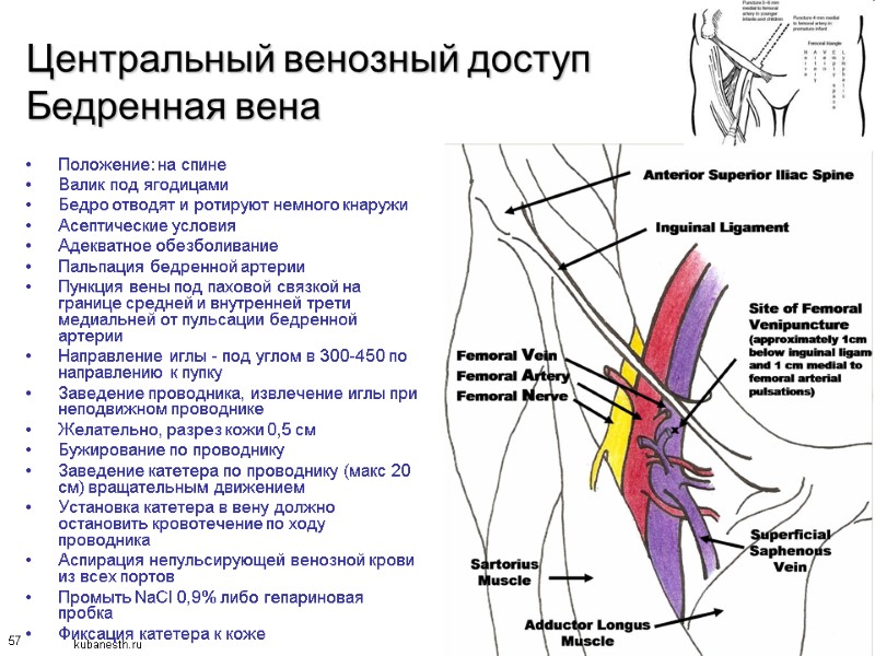 57 Центральный венозный доступ Бедренная вена Положение: на спине Валик под ягодицами Бедро отводят